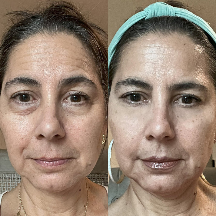 The Lumi-Revive Eye Wand