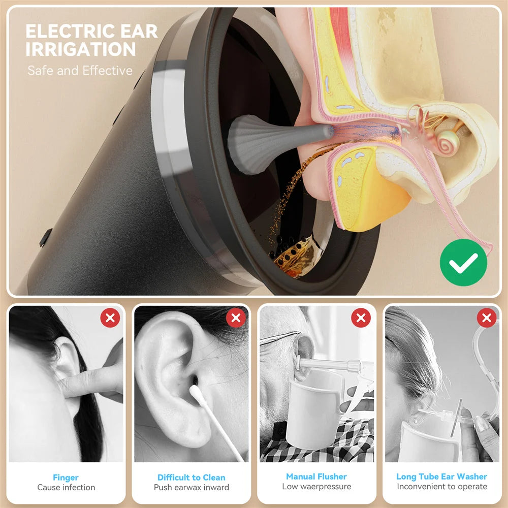 SUNUO Electric Ear Wax Removal System