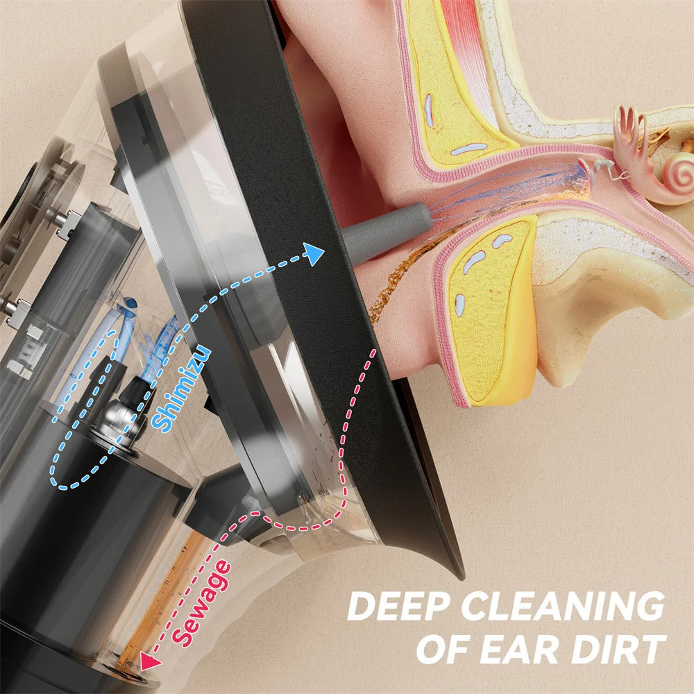 SUNUO Electric Ear Wax Removal System