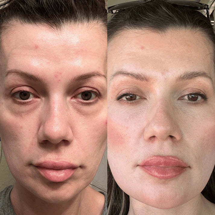 The Lumi-Revive Eye Wand