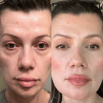 The Lumi-Revive Eye Wand