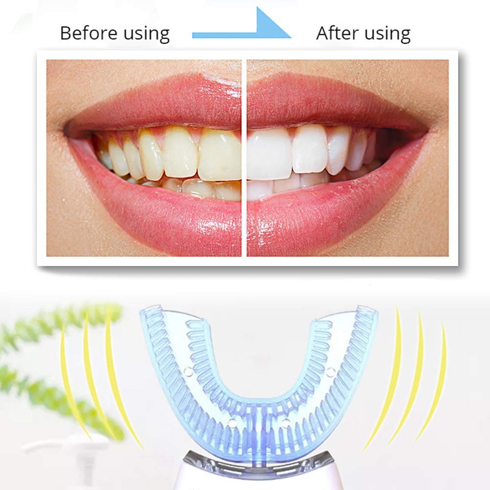 The Sonic Smile Pro